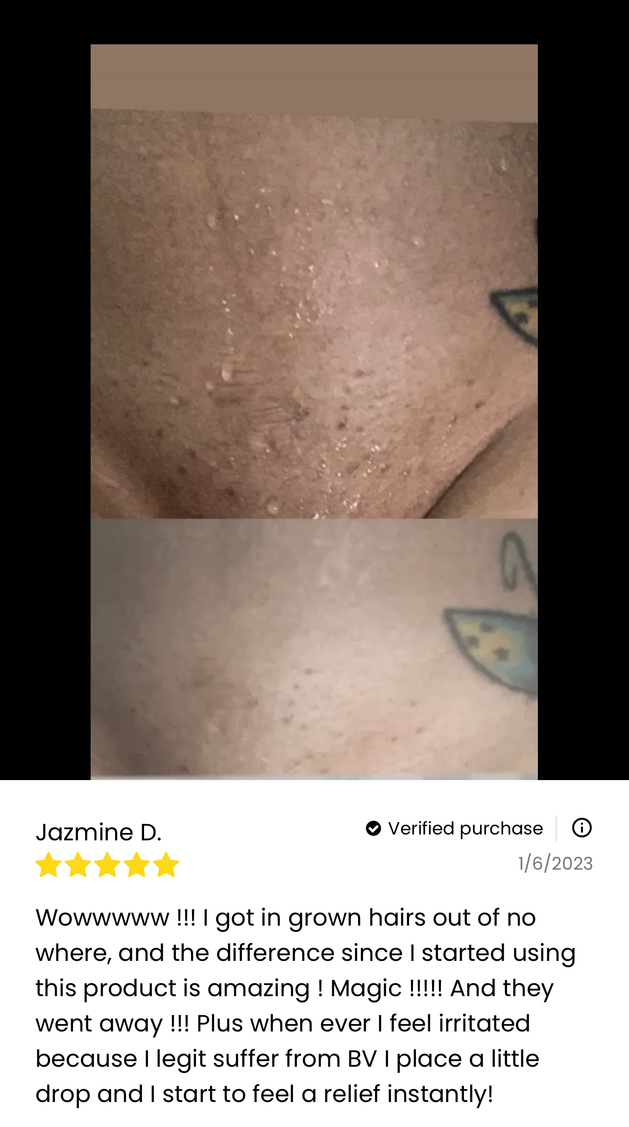 Her Fantasy Box Renew Her Yoni Oil - For Dryness, Ingrown Hair, Dark Marks & Scars - Image 5